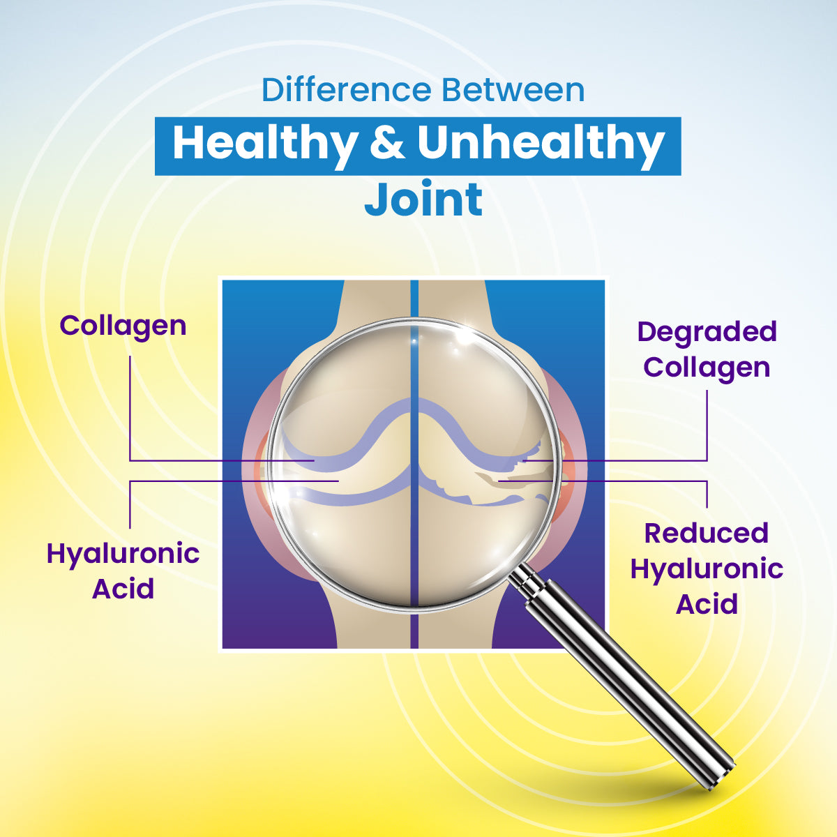 Advanced Joint Care