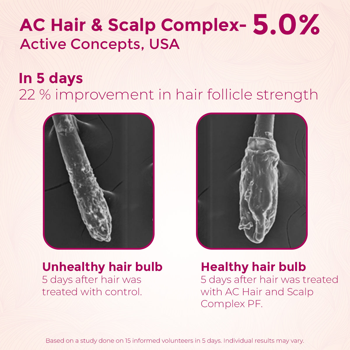 Healthyr-U Anti-Hair Fall Overnight Serum AC Hair & Scalp Complex study